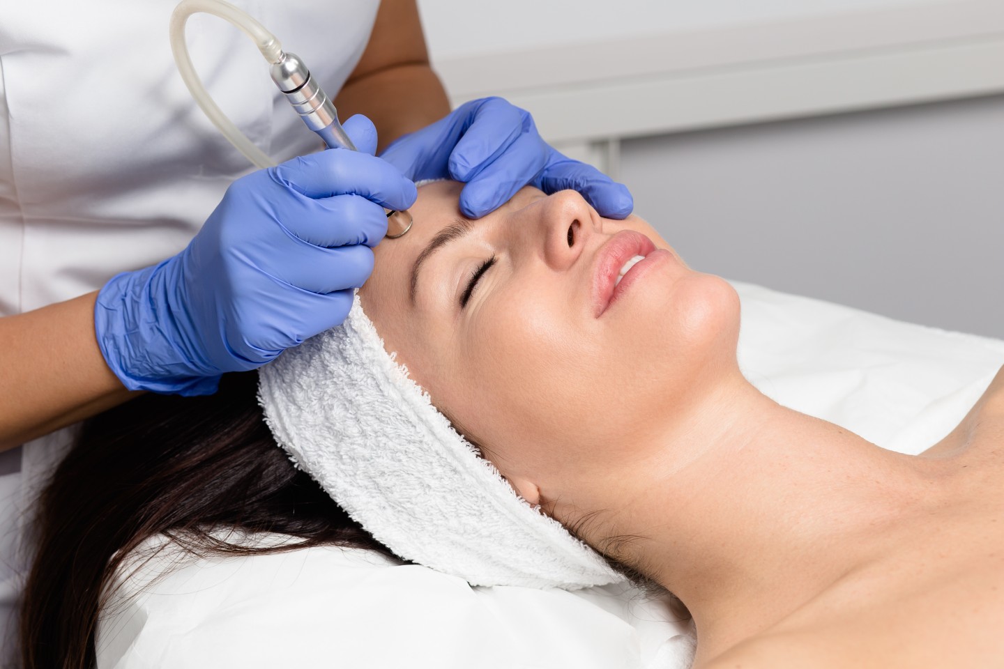 dermabrasion services in san antonio